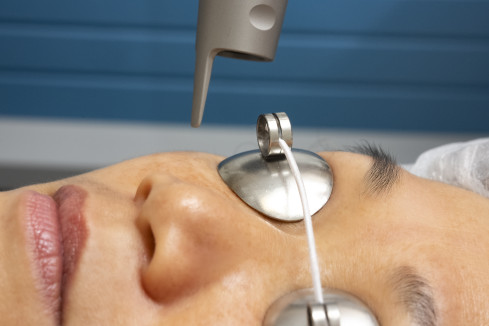 Thumbnail of Cosmetic Laser Treatment