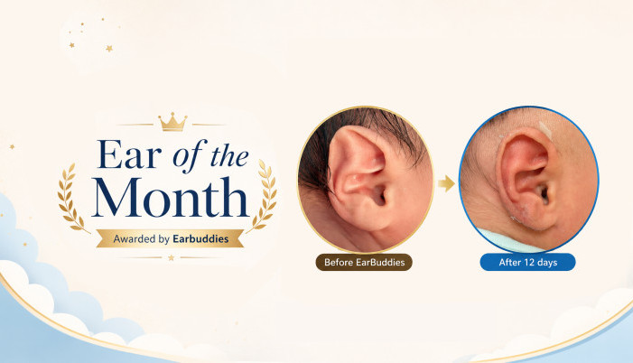 Awarded “Ear of the Month” by Earbuddies!