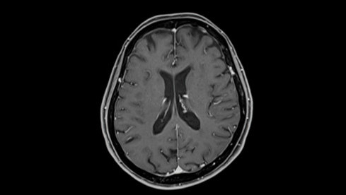 Thumbnail of Magnetic Resonance Imaging