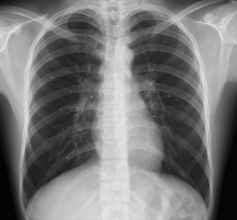 Thumbnail of General X-ray