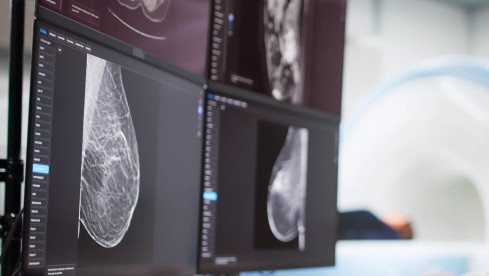 Thumbnail of Triple Assessment