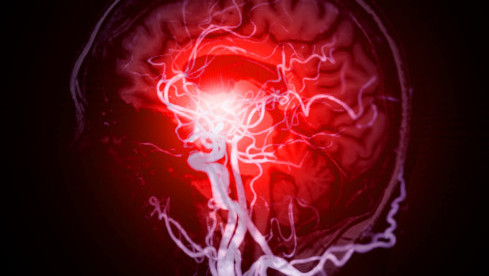 Thumbnail of Brain Health Assessment Programme