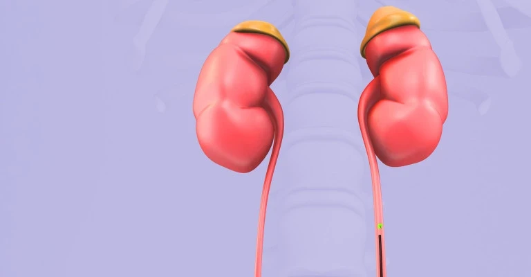 HKSH Lithotripsy Centre