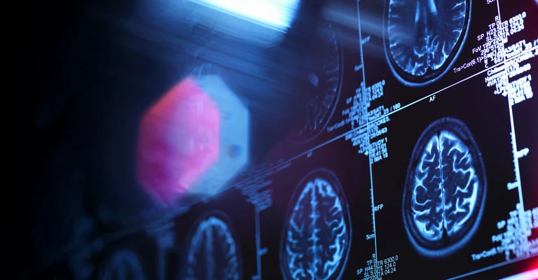 Clinical Neuroscience