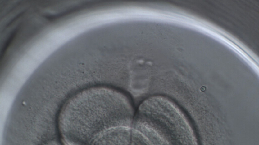 Thumbnail of Assisted Hatching (AH)