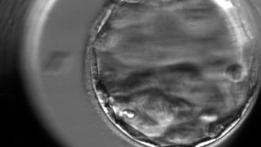 Thumbnail of Blastocyst Transfer